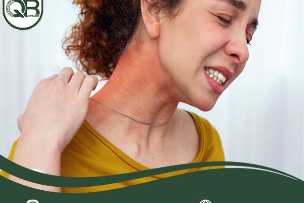 عوامل ایجادکننده حساسیت به زیورآلات نقره و روش‌ های رفع آن