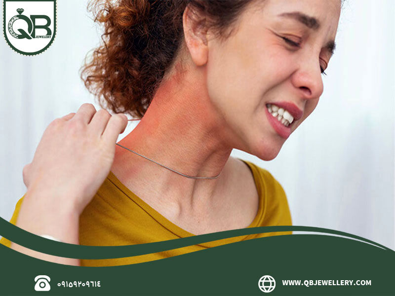 عوامل ایجادکننده حساسیت به زیورآلات نقره و روش‌ های رفع آن