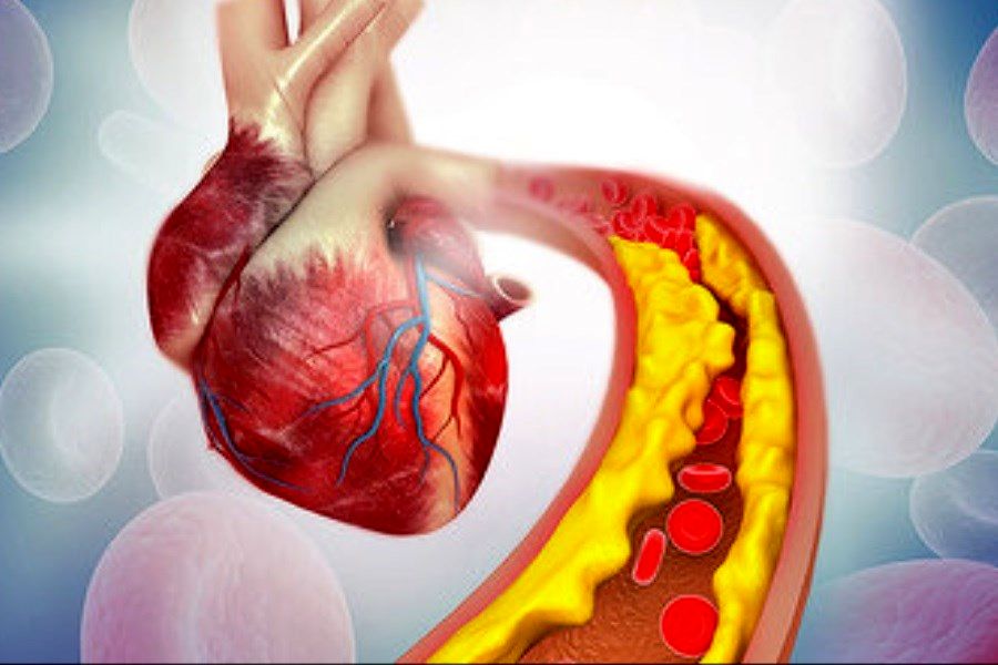 علائم هشدار کلسترول بالا در بدن را بدانید